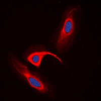 CBR1 Rabbit Polyclonal Antibody