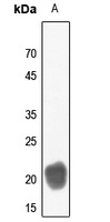 CD3d Rabbit Polyclonal Antibody