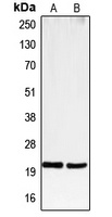 CD3e Rabbit Polyclonal Antibody
