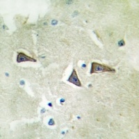 CD4 Rabbit Polyclonal Antibody