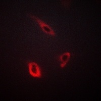 CD4 Rabbit Polyclonal Antibody