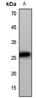 CD9 Rabbit Polyclonal Antibody