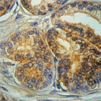 CD9 Rabbit Polyclonal Antibody