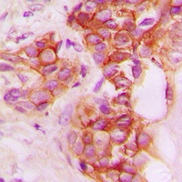 CD40 Rabbit Polyclonal Antibody