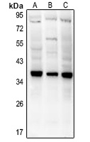 CD154 Rabbit Polyclonal Antibody