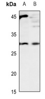 CD70 Rabbit Polyclonal Antibody