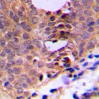 CDC2 (Phospho-T161) Rabbit Polyclonal Antibody