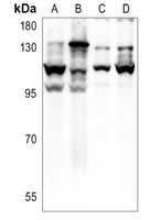 E Cadherin Rabbit Polyclonal Antibody