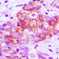E Cadherin Rabbit Polyclonal Antibody