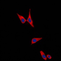 E Cadherin Rabbit Polyclonal Antibody