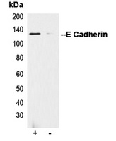 E Cadherin Rabbit Polyclonal Antibody