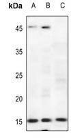 p15 INK4b Rabbit Polyclonal Antibody