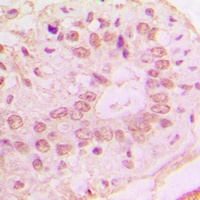 p15 INK4b Rabbit Polyclonal Antibody