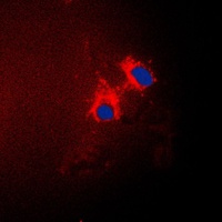 p15 INK4b Rabbit Polyclonal Antibody