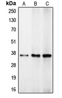 C/EBP beta Rabbit Polyclonal Antibody
