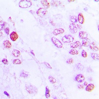 C/EBP beta Rabbit Polyclonal Antibody