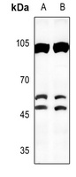 C/EBP beta Rabbit Polyclonal Antibody