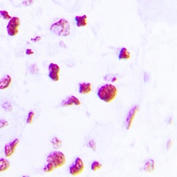 C/EBP beta Rabbit Polyclonal Antibody