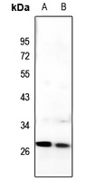 C/EBP delta/epsilon Rabbit Polyclonal Antibody
