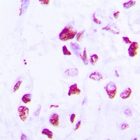 C/EBP delta/epsilon Rabbit Polyclonal Antibody