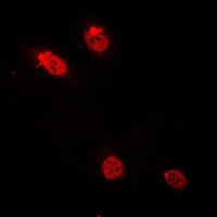 C/EBP delta/epsilon Rabbit Polyclonal Antibody