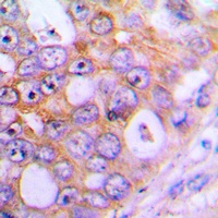 CHML Rabbit Polyclonal Antibody