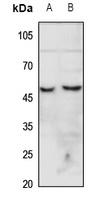 CHRNA7 Rabbit Polyclonal Antibody