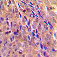 IKK alpha (Phospho-T23) Rabbit Polyclonal Antibody