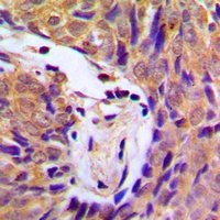 IKK alpha/beta (Phospho-S180/181) Rabbit Polyclonal Antibody