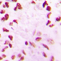 CLK2 Rabbit Polyclonal Antibody
