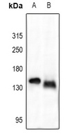 Collagen 1 alpha 2 Rabbit Polyclonal Antibody