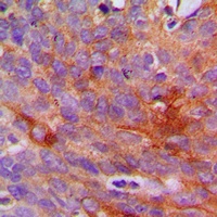 Collagen 1 alpha 2 Rabbit Polyclonal Antibody
