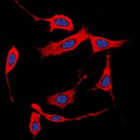 Collagen 1 alpha 2 Rabbit Polyclonal Antibody