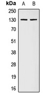 Collagen 1 alpha 2 Rabbit Polyclonal Antibody