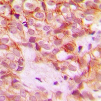 Collagen 1 alpha 2 Rabbit Polyclonal Antibody