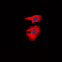 Collagen 1 alpha 2 Rabbit Polyclonal Antibody