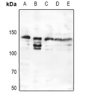 Collagen 3 alpha 1 Rabbit Polyclonal Antibody