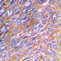 Collagen 3 alpha 1 Rabbit Polyclonal Antibody