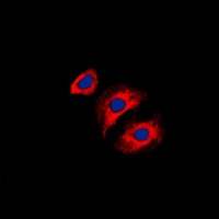 Collagen 3 alpha 1 Rabbit Polyclonal Antibody