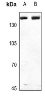 Collagen 3 alpha 1 Rabbit Polyclonal Antibody