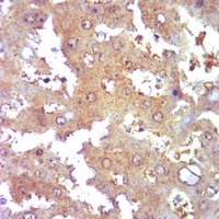 Collagen 3 alpha 1 Rabbit Polyclonal Antibody