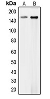 Collagen 4 alpha 1 Rabbit Polyclonal Antibody