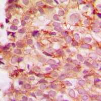 Collagen 4 alpha 1 Rabbit Polyclonal Antibody