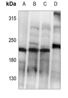 Collagen 5 alpha 1 Rabbit Polyclonal Antibody