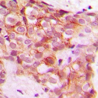 Collagen 5 alpha 1 Rabbit Polyclonal Antibody