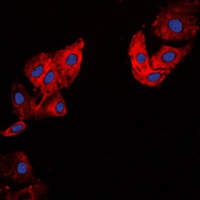 Collagen 5 alpha 1 Rabbit Polyclonal Antibody