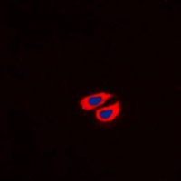 Collagen 6 alpha 2 Rabbit Polyclonal Antibody