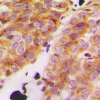 Collagen 11 alpha 1 Rabbit Polyclonal Antibody