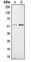Carboxypeptidase E Rabbit Polyclonal Antibody