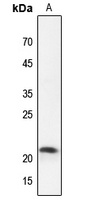 Claudin 4 Rabbit Polyclonal Antibody